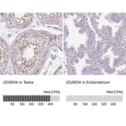 IZUMO4 Antibody, Novus Biologicals 25 &mu;L, Unlabeled:Antibodies, Polyclonal